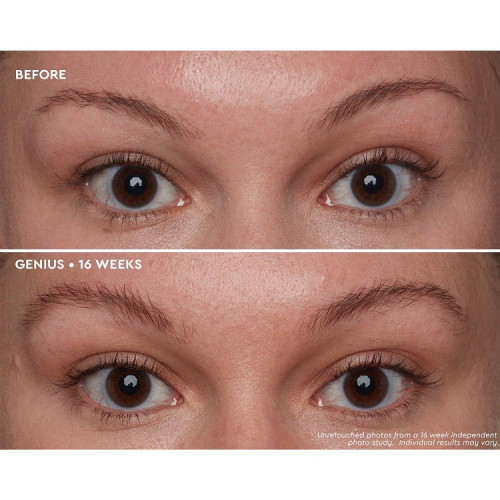 Kondicionuojamasis Antakių Serumas Brow Genius®